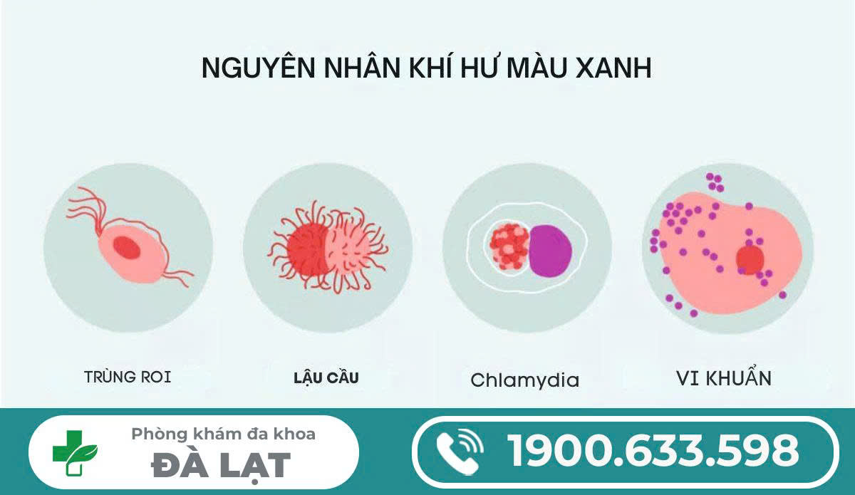 Hình ảnh minh họa